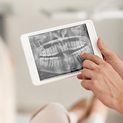 Digital dental x-rays on tablet computer