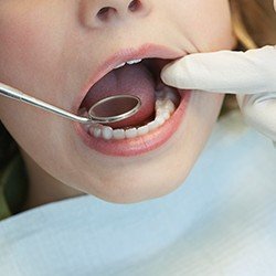 closeup of child during dental exam