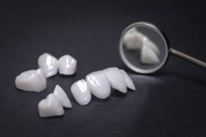 a set of temporary veneers set on a dentist’s table